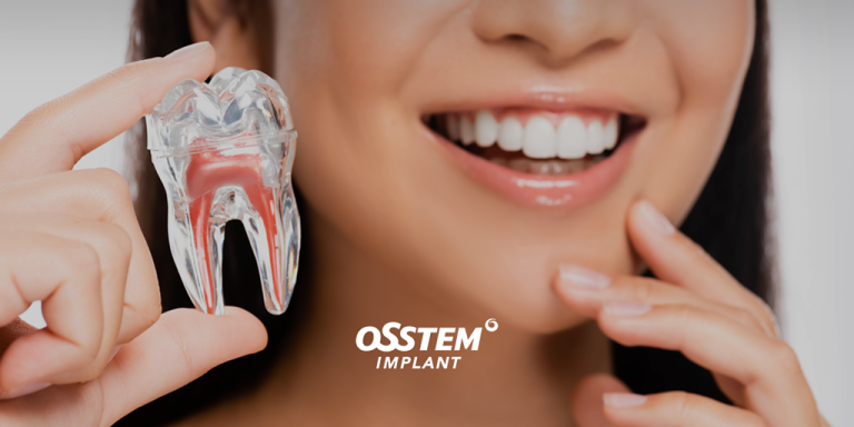 Имплантация зубов системой Osstem Implant Минск ДИМЕДА